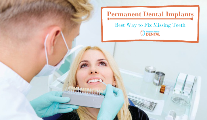 Permanent Dental Implants