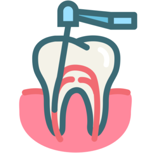 Root Canal Treatment Modesto