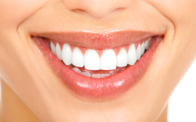 Types of Teeth Whitening Treatments