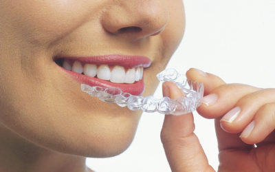 Invisalign Dentist in Modesto