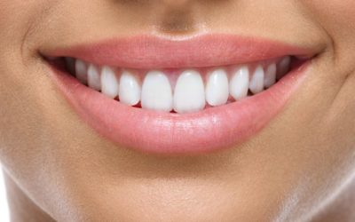 How Dental Bridge Treatment Works ?