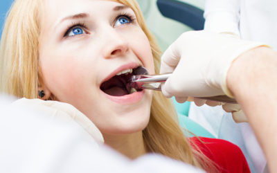 How tooth extraction process is done?