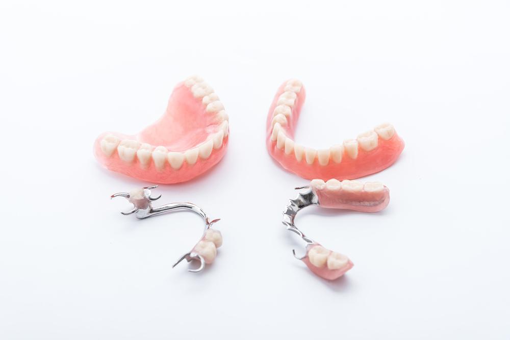 Implant dentist Modesto