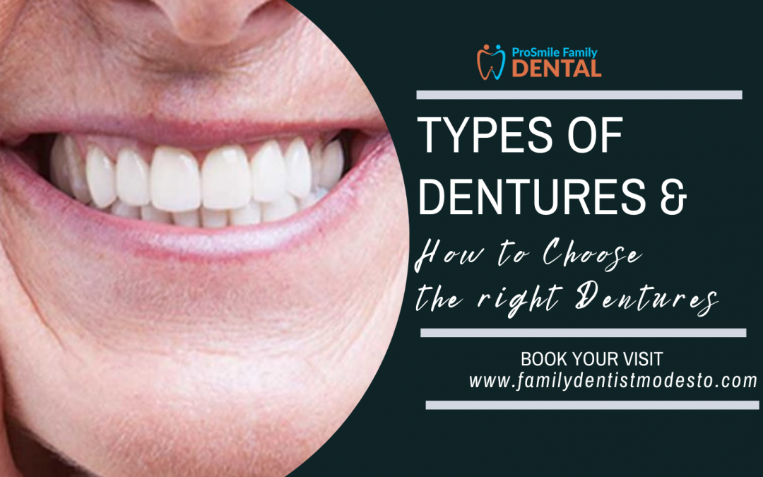 Types of Dentures and How to Choose the Best One?
