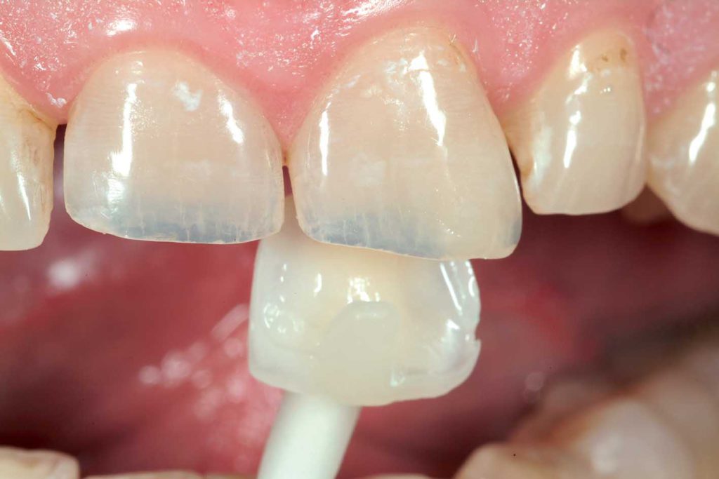 Implant dentist Modesto