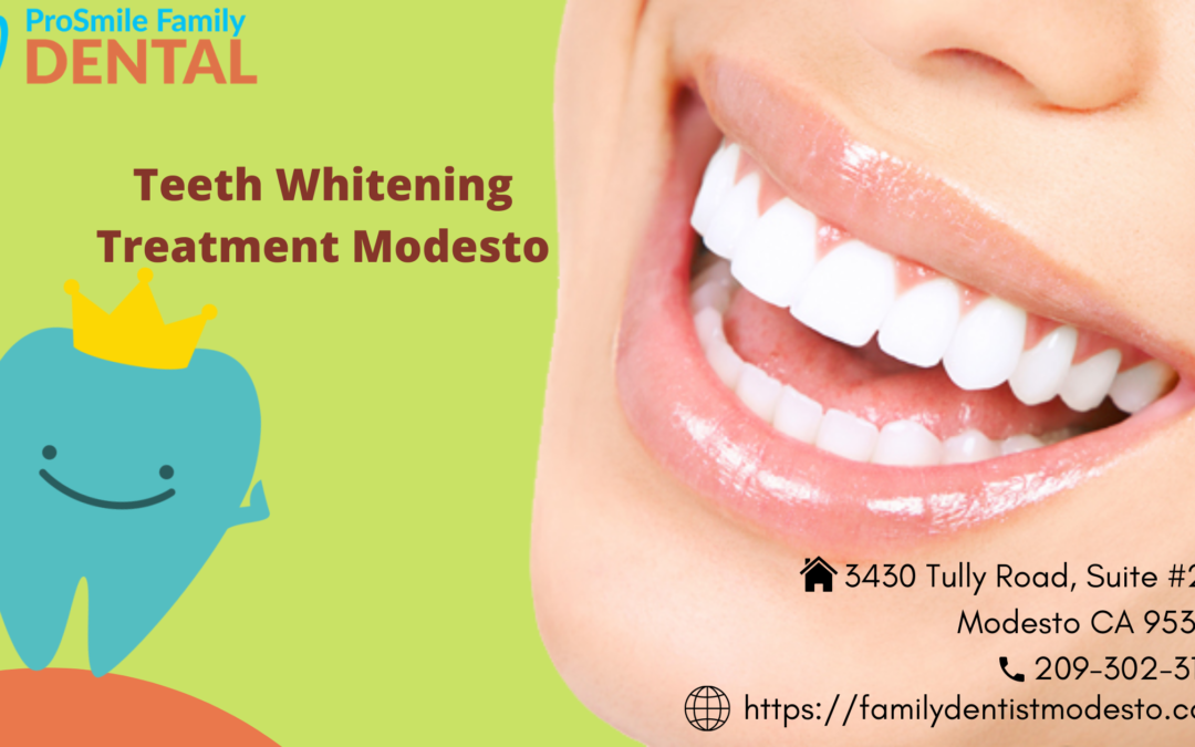 Lists of professional teeth whitening procedures