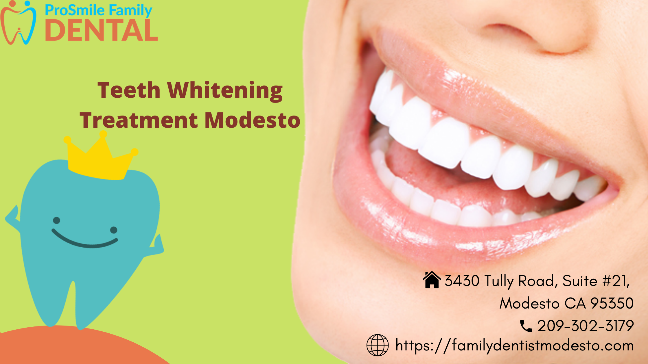 teeth whitening treatment modesto
