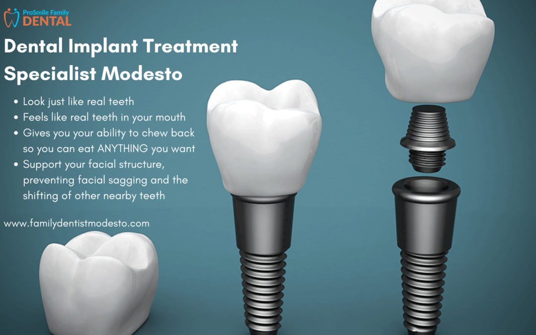 Implant dentist modesto