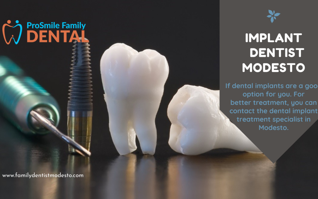 Implant Dentist Modesto | Dentist Modesto