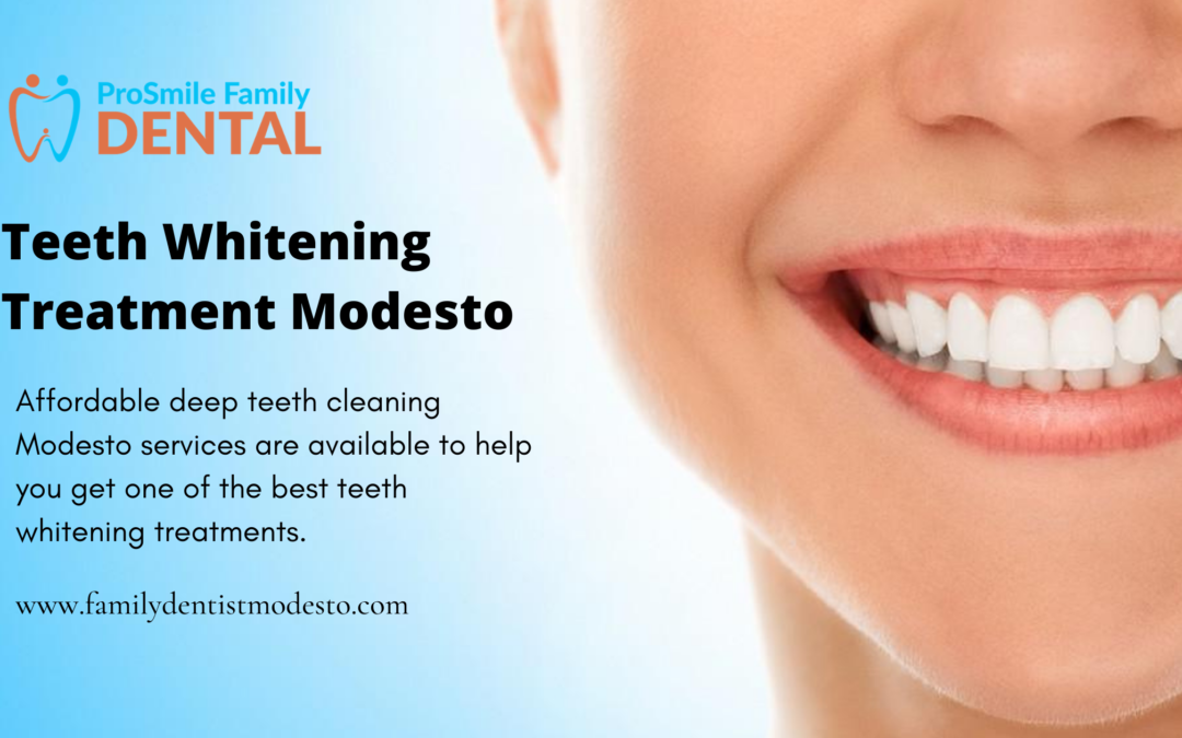 Why you should choose teeth whitening treatment Modesto services?