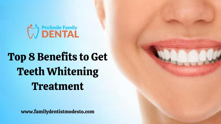 Top Benefits of Teeth Whitening Treatment