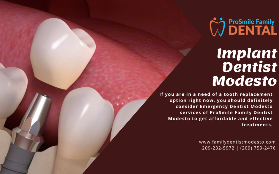 Why do you need dental implants from dentist Modesto professionals?