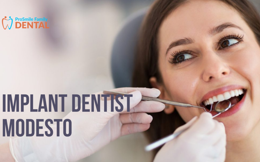 Why hire implant dentist Modesto services?