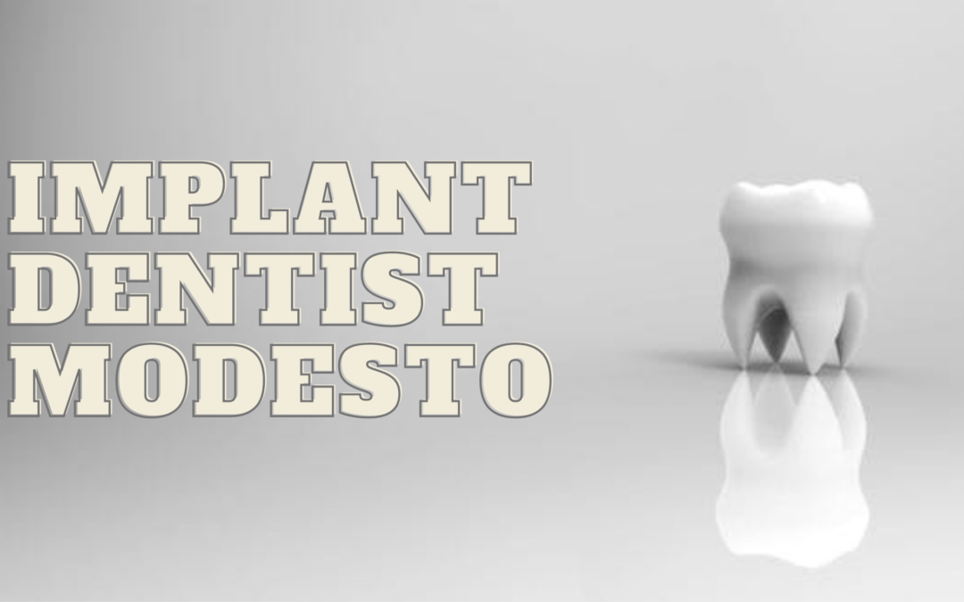 Why would you need implant dentist Modesto services?