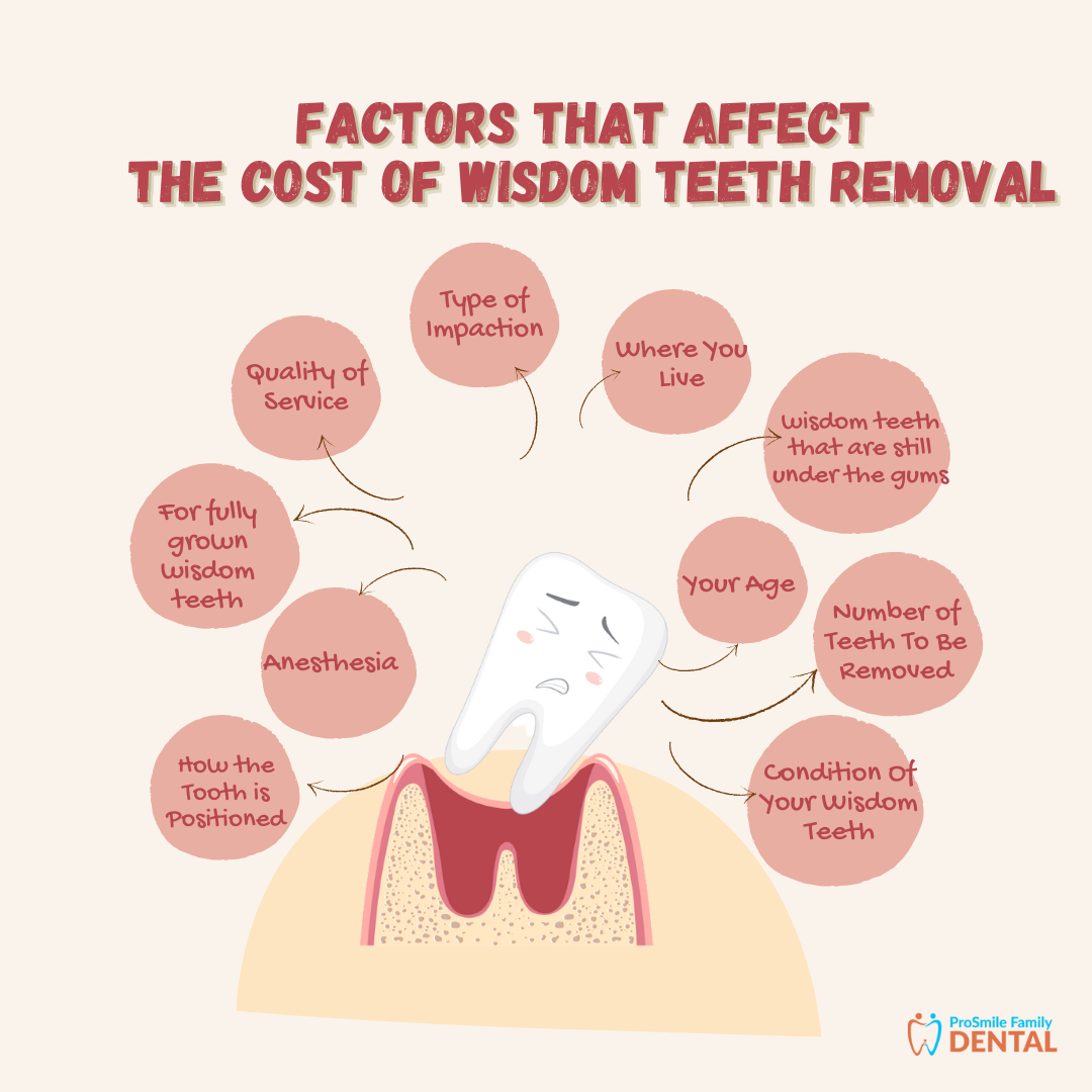 Factors affecting Cost of Wisdom Teeth Removal