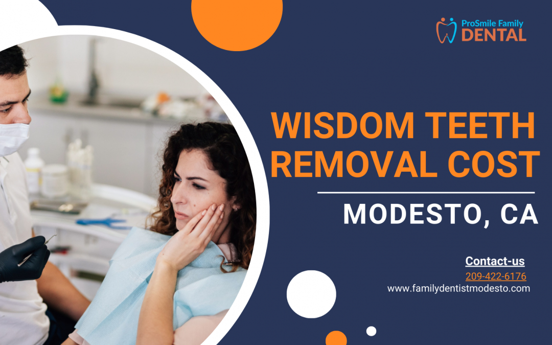 How Much Does it Cost to Remove Wisdom Teeth in Modesto, CA?