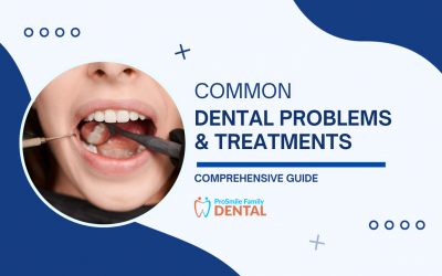 10+ Common Dental Problems & Treatments [Guide 2023]