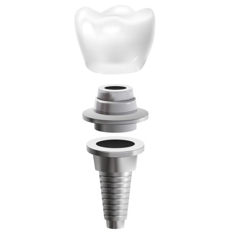 Dental Implants Modesto CA