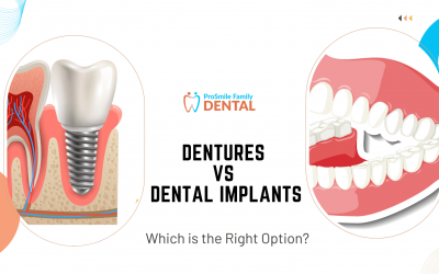 Dentures vs Dental Implants: Which is the Best Option?