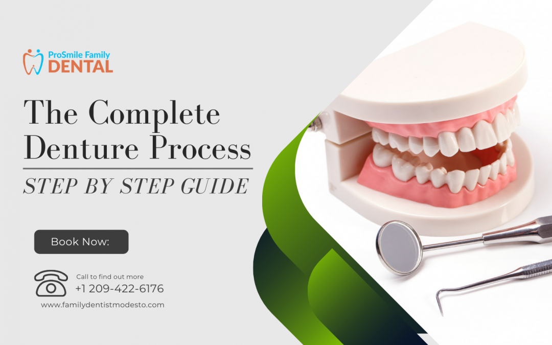 The Complete Denture Process – Step By Step Guide