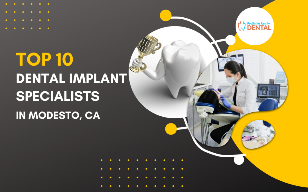 Top 10 Dental Implant Specialists in Modesto, CA [Updated 2023]