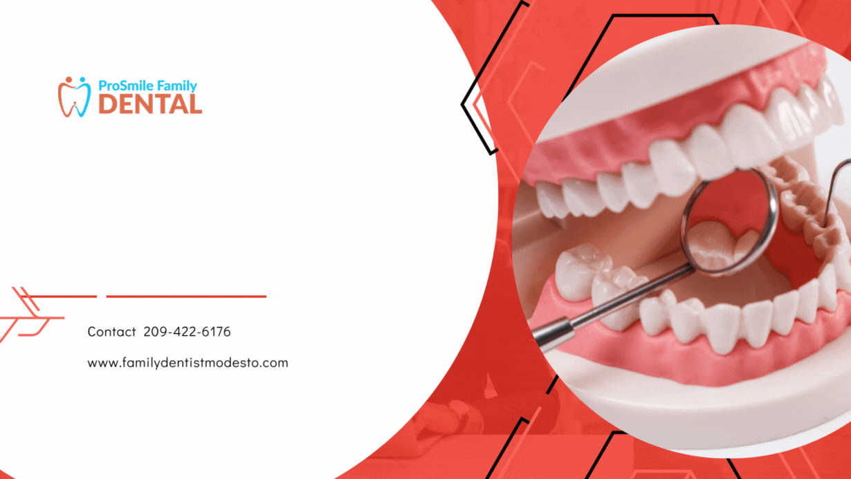 Family Dentist Modesto Blog Expert Dental Care Tip