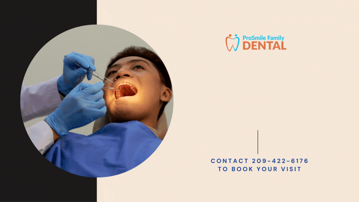 Family Dentist Modesto Blog Expert Dental Care Tip